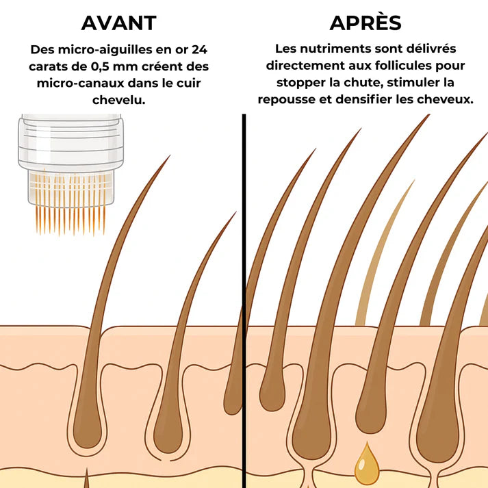 Protocole Velyss® — Repousse Capillaire Naturelle